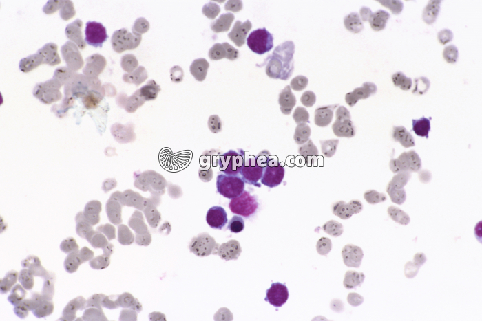 Métastase sanguine x200 - gryphea.com